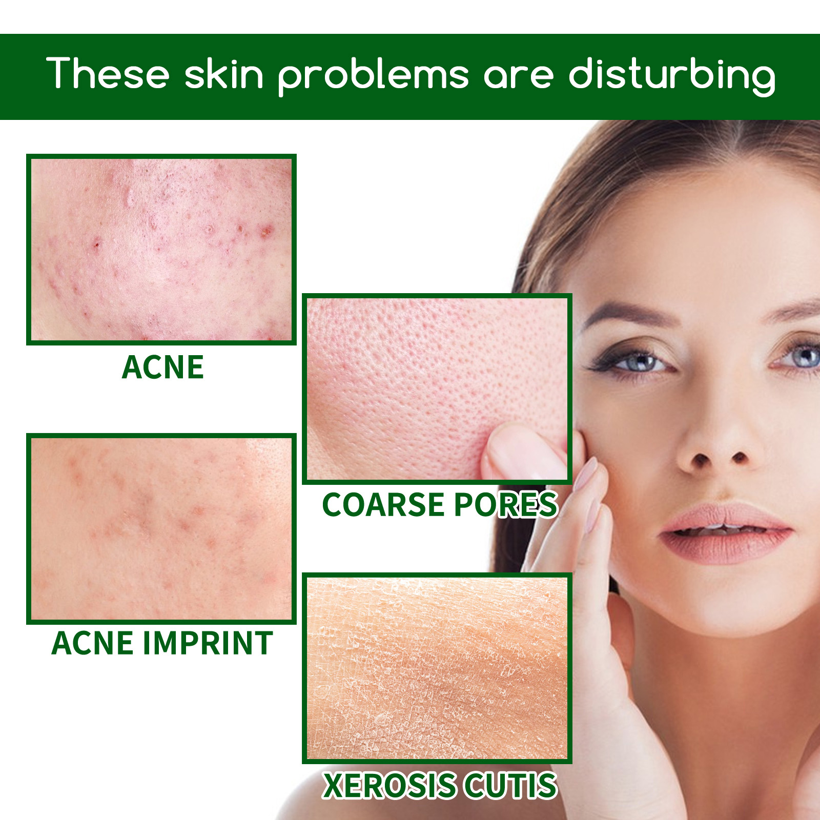 Salicylic Acid Anti Acn-e Face - Tranexamic Acid Serum incelemesi ve fiyatı