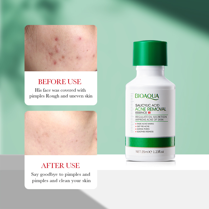 35ml BIOAOUA Salicylic Acid An - Tranexamic Acid Serum incelemesi ve fiyatı