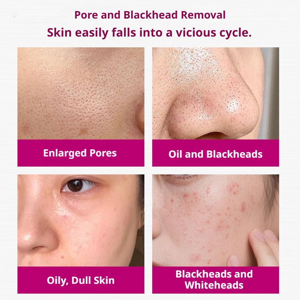 Salicylic Acid Shrink Pores Se - Tranexamic Acid Serum incelemesi ve fiyatı