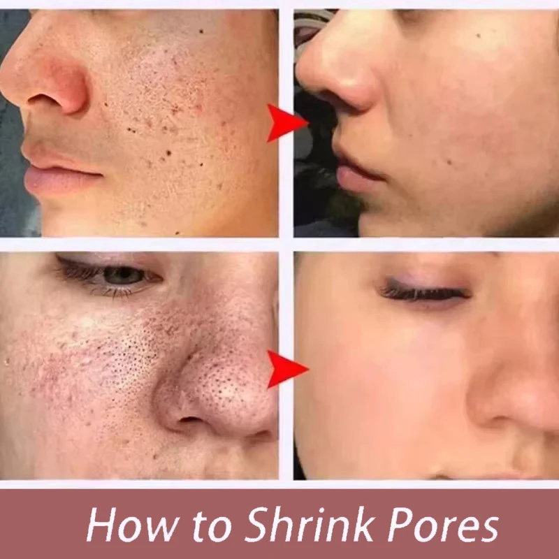 Day by Day, Pores Look Smaller - Tranexamic Acid Serum incelemesi ve fiyatı