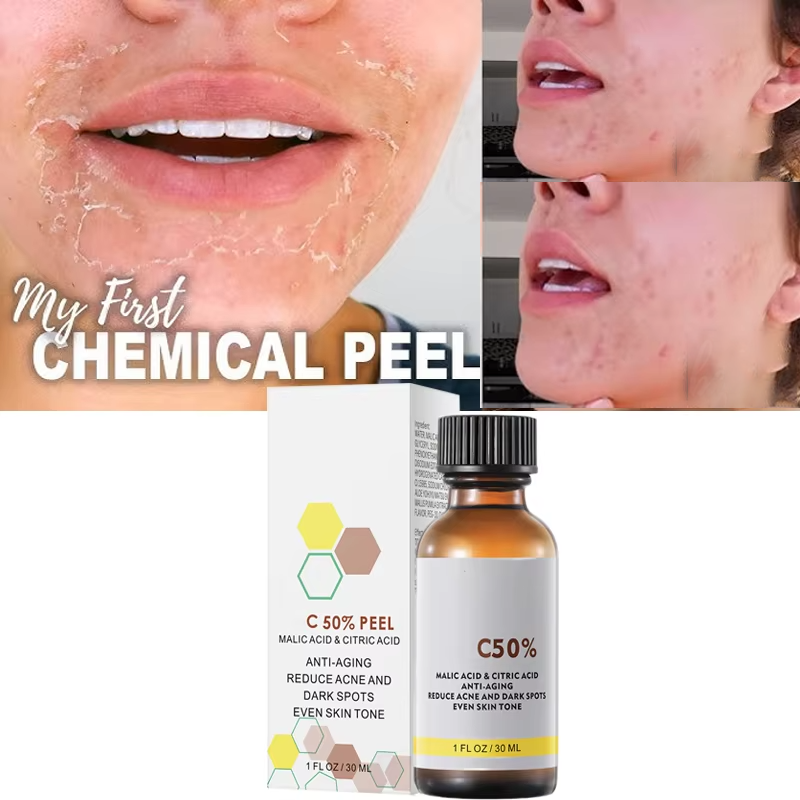With Malic Acid And Citric Aci - Tranexamic Acid Serum incelemesi ve fiyatı