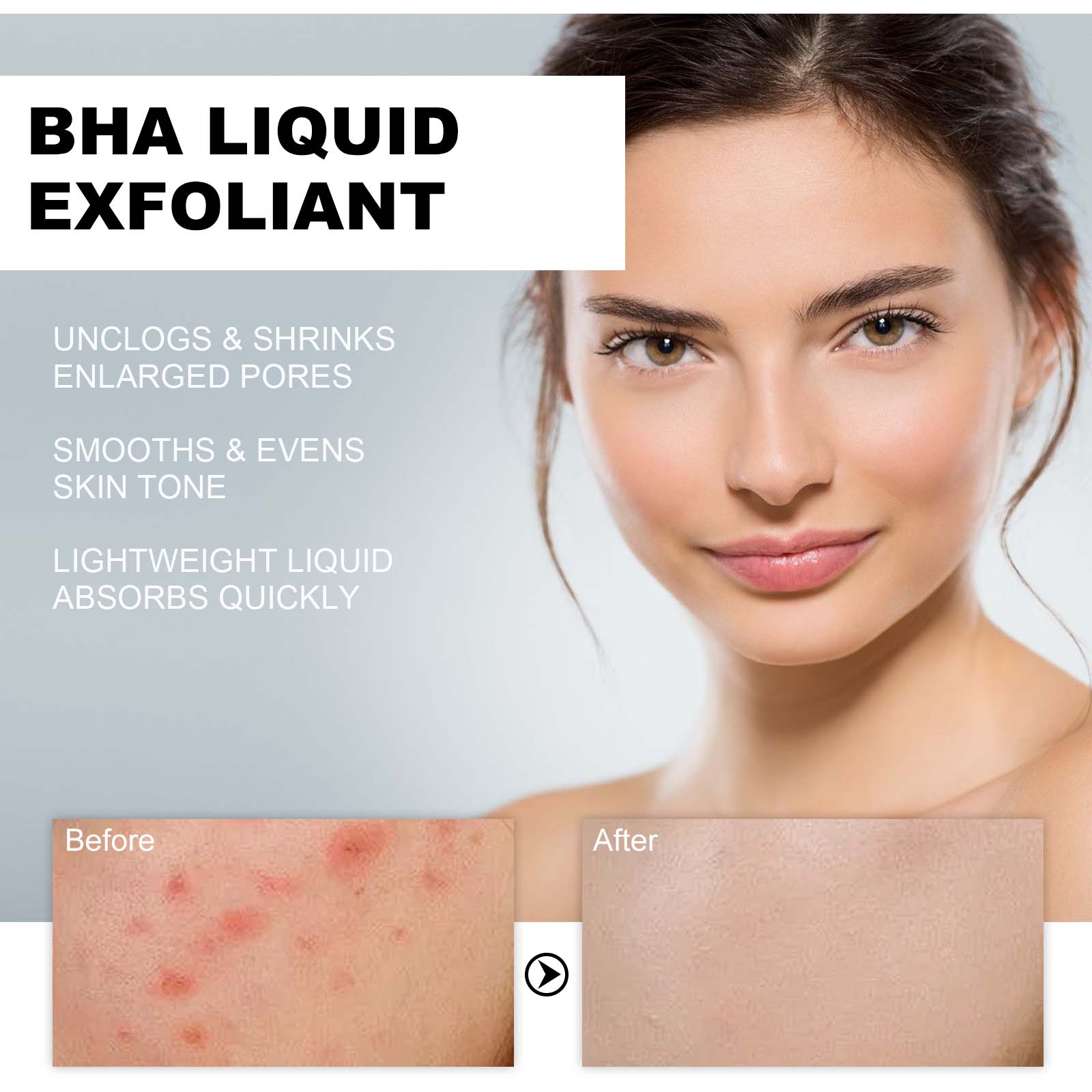 2% Salicylic Acid Liquid Exfol - Tranexamic Acid Serum incelemesi ve fiyatı