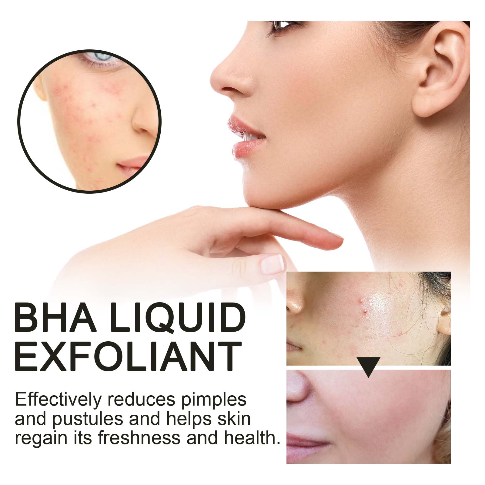 2% Salicylic Acid Liquid Exfol - Tranexamic Acid Serum incelemesi ve fiyatı