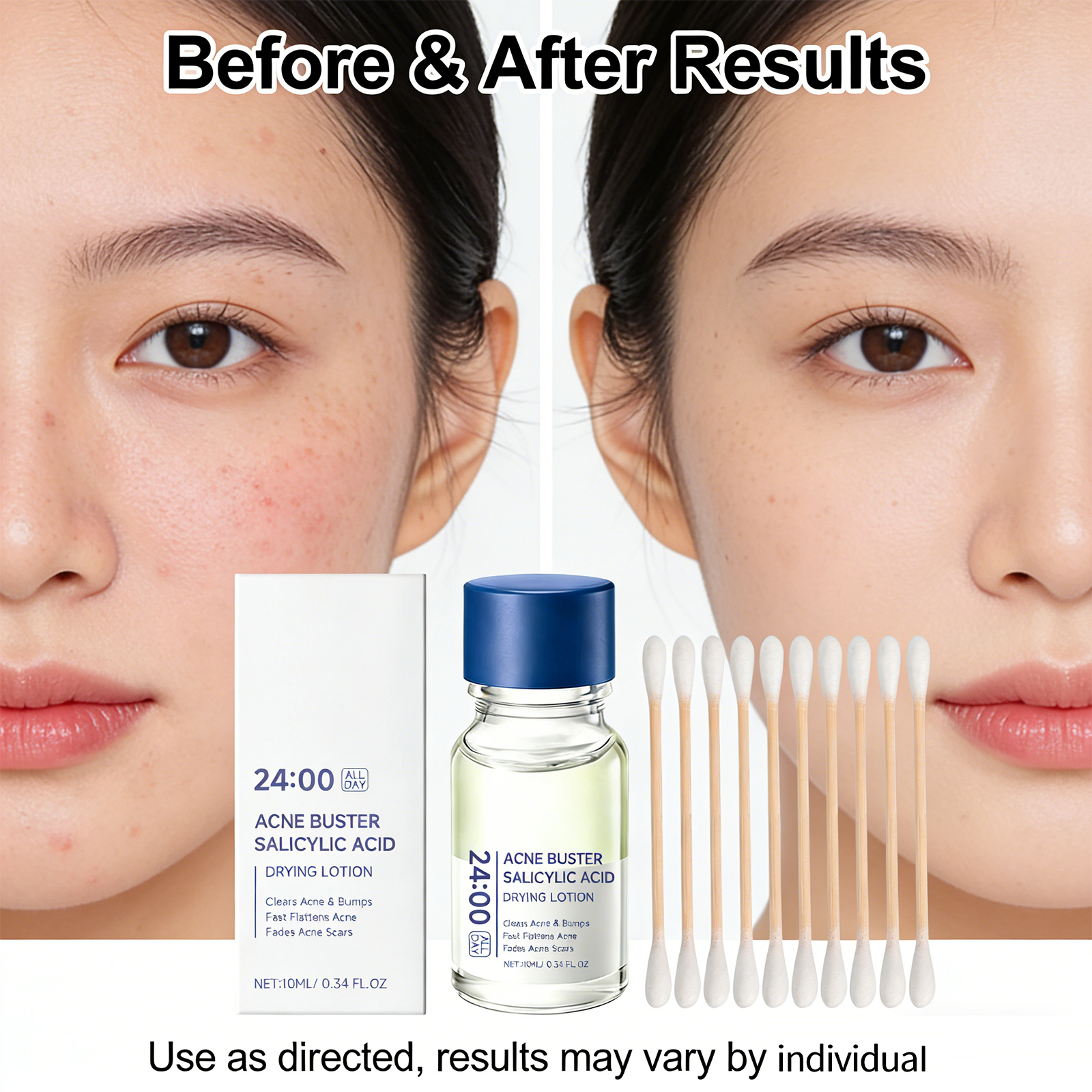 Salicylic Acid Drying Lotion F - Tranexamic Acid Serum incelemesi ve fiyatı